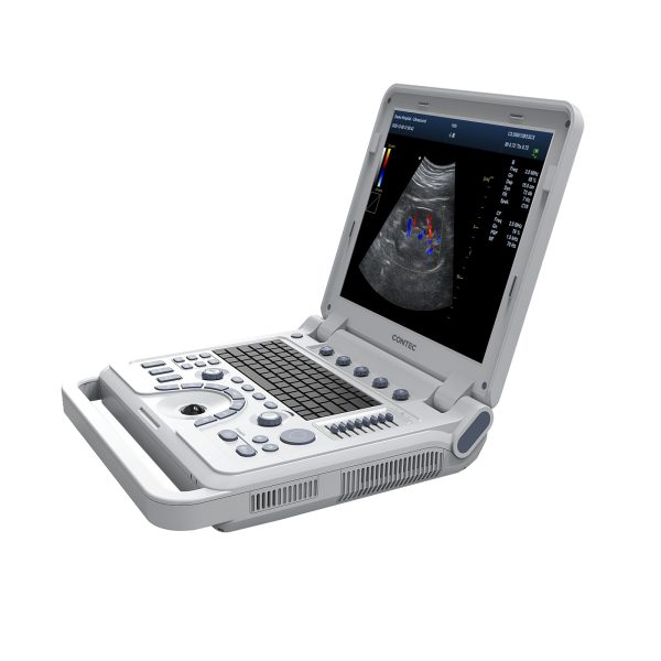 VET Veterinary Portable Ultrasound Scanner Laptop Machine Color Doppler For Pregnancy In Animals - Image 2