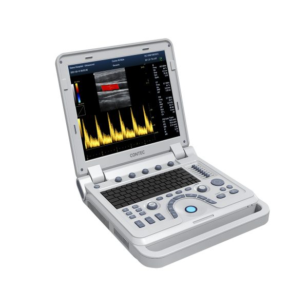 VET Veterinary Portable Ultrasound Scanner Laptop Machine Color Doppler For Pregnancy In Animals - Image 5