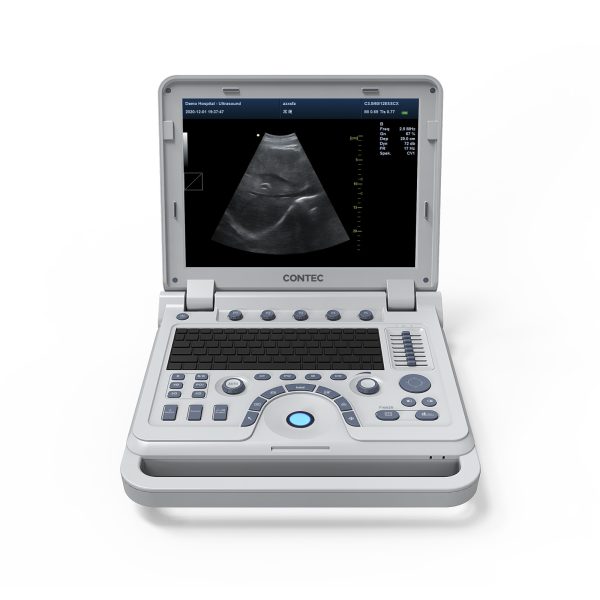 VET Veterinary Portable Ultrasound Scanner Laptop Machine Color Doppler For Pregnancy In Animals - Image 3